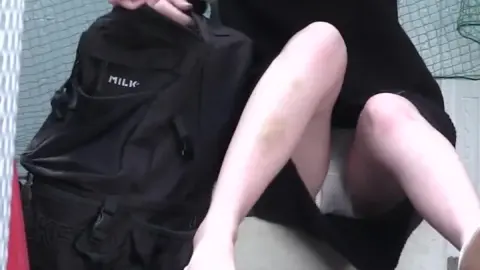 Asian girl with bruises outdoors