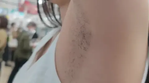 Asian Woman Shows Underarm Hair