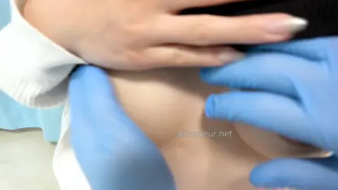 Asian Nurses Exposed in Medical Exam